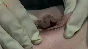 bdsm,pussy,medical-play,gyno,cunt