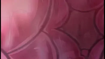 total-drama-island,zone,cartoon,futa,braces